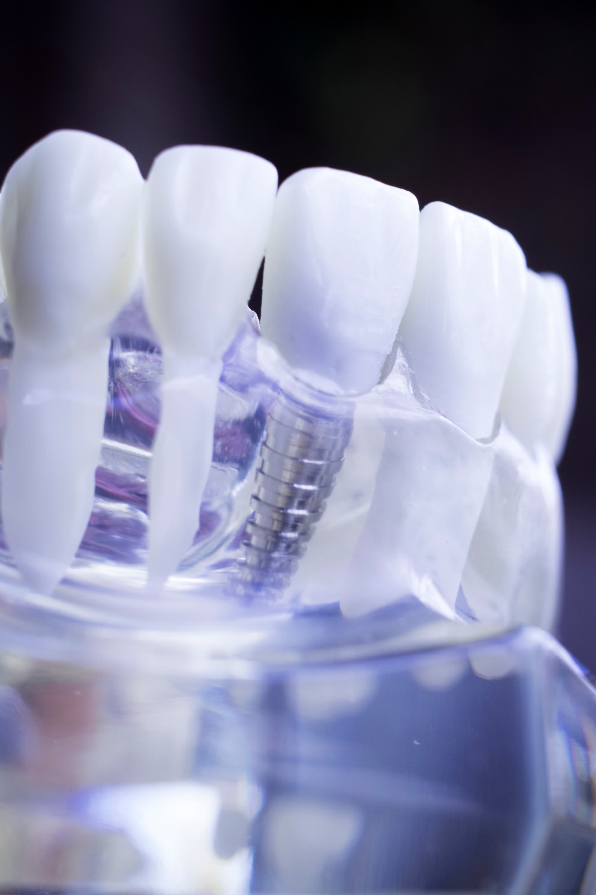 Oral health screening and protective dental treatment in Irvine CA