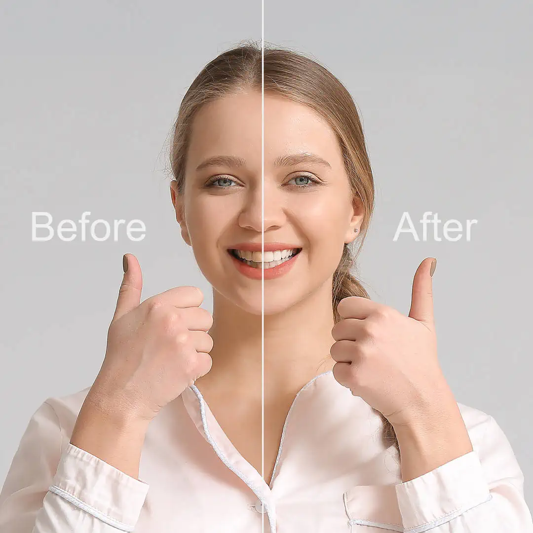 Smile Makeovers in Irvine CA