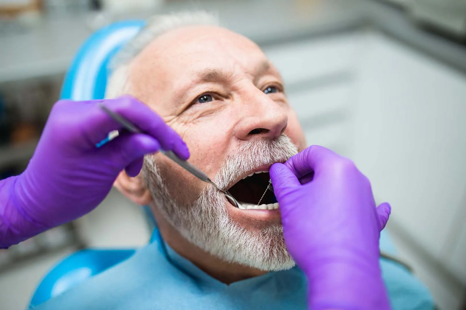 What Happens If Something Is Found — Oral Cancer Screening in Irvine, CA