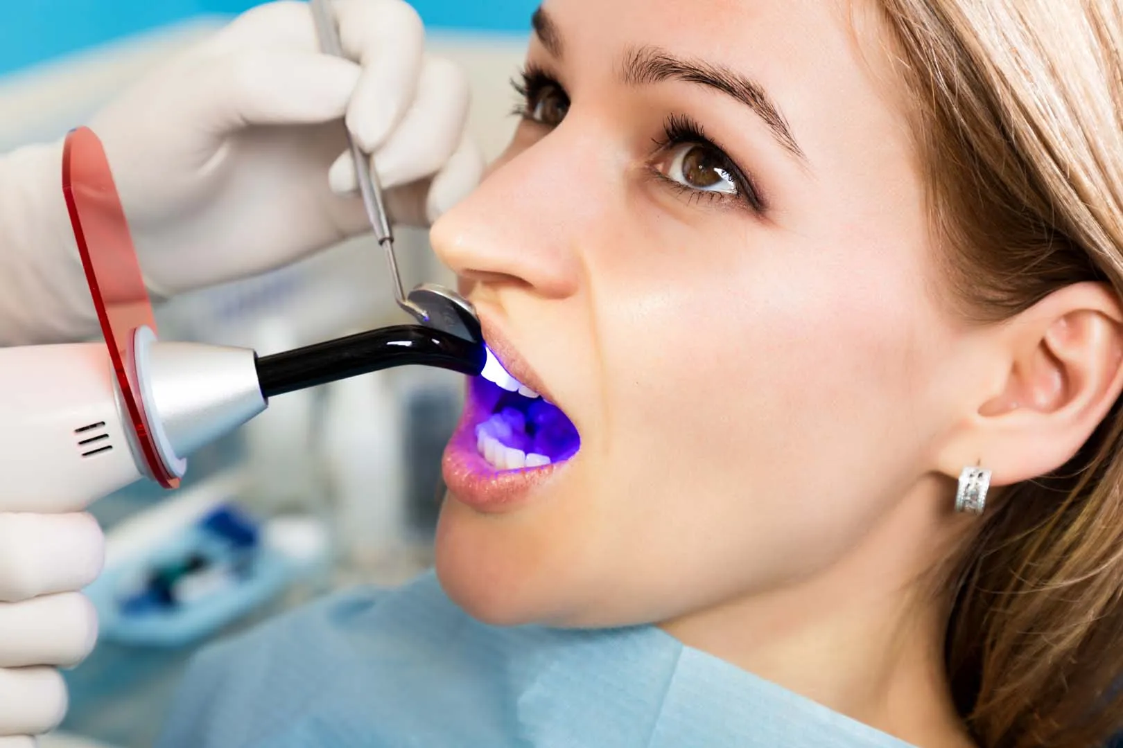 Step-by-Step: From Diagnosis to Completed Restoration — Dental Fillings in Irvine, CA