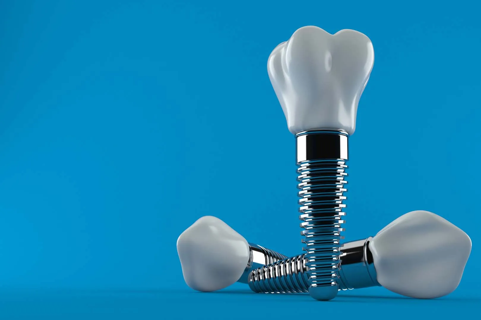 Implant Placement and Healing — Dental Implants in Irvine, CA