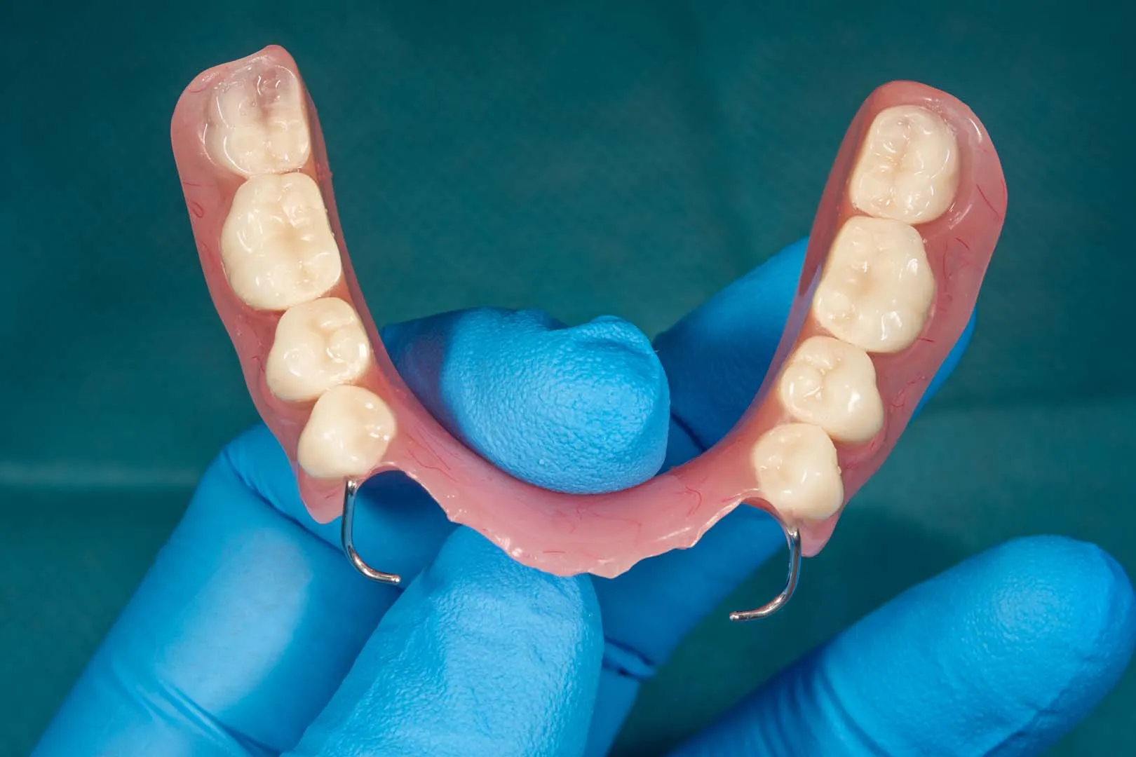 Caring for Your Dentures — Dentures in Irvine, CA