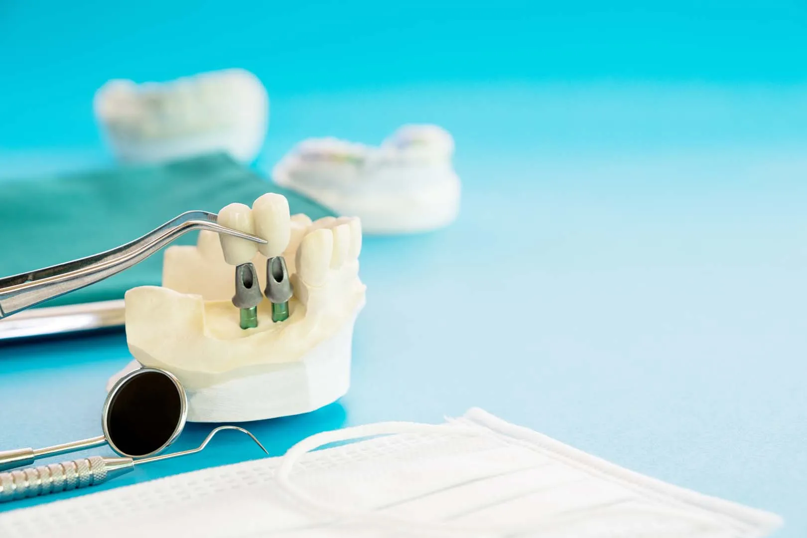 Consultation, 3D Imaging, and Treatment Planning — Implant Overdentures in Irvine, CA