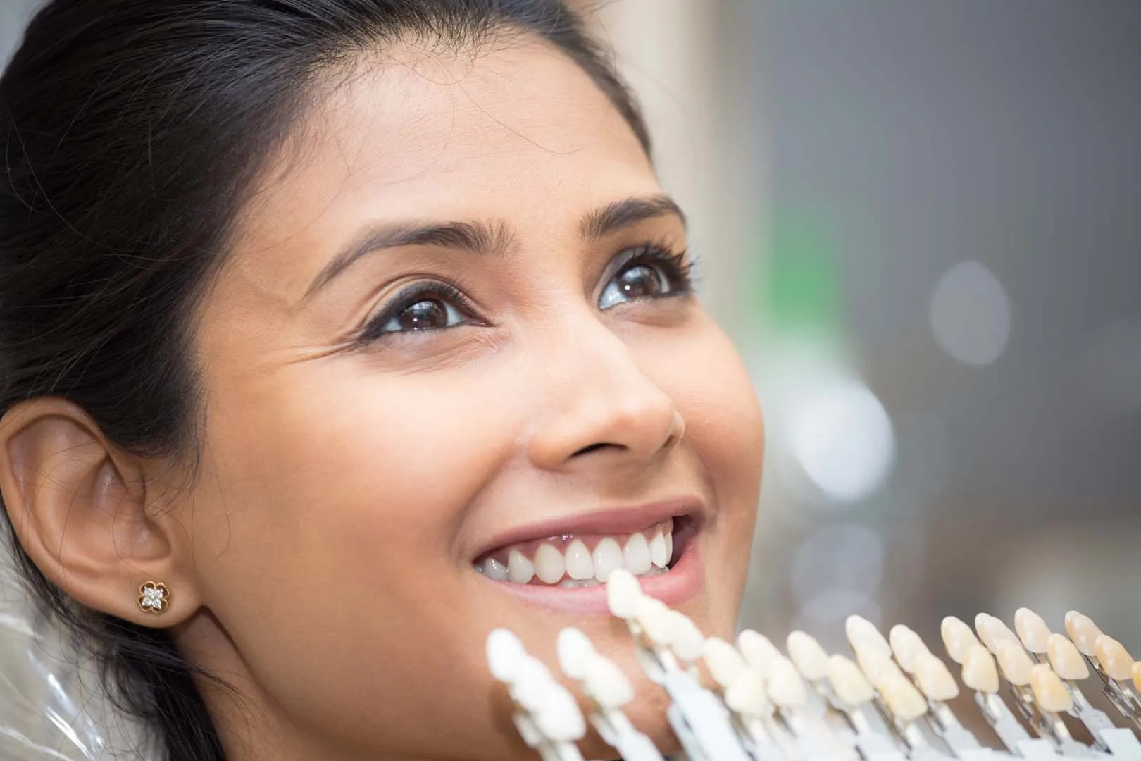 Care and Longevity After Your Veneers — Porcelain Veneers in Irvine, CA