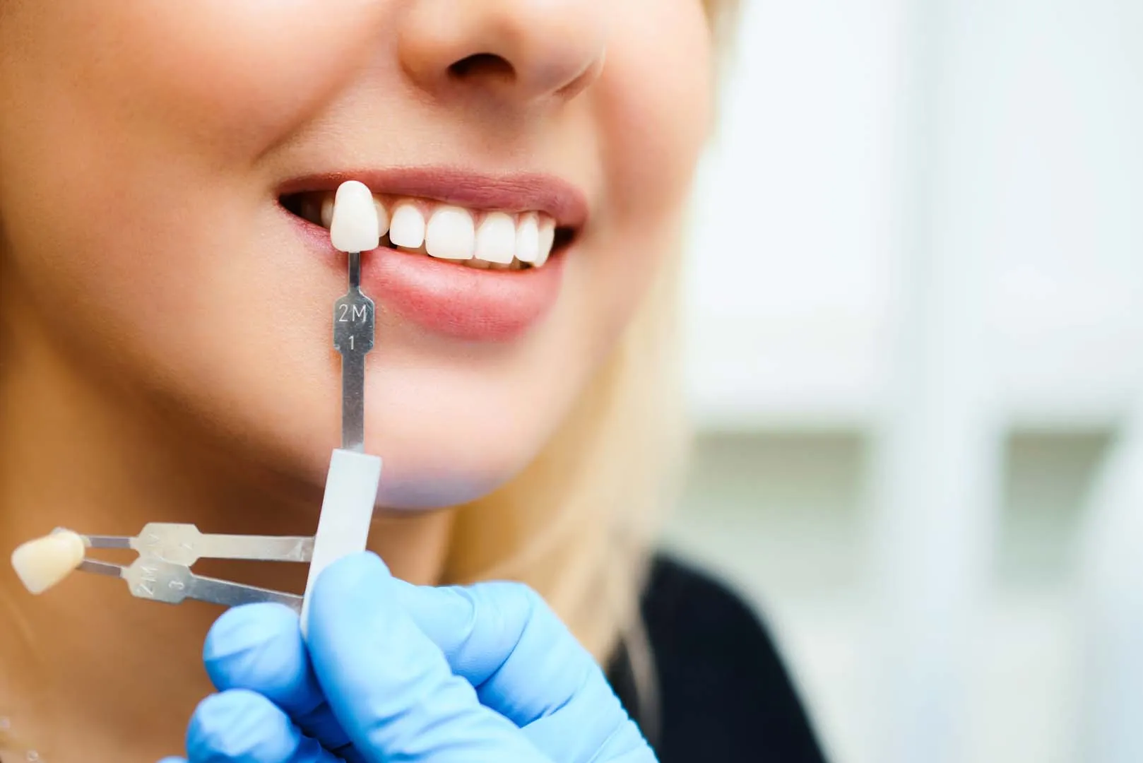 Results, Longevity, and How to Protect Your Investment — Smile Makeovers in Irvine, CA