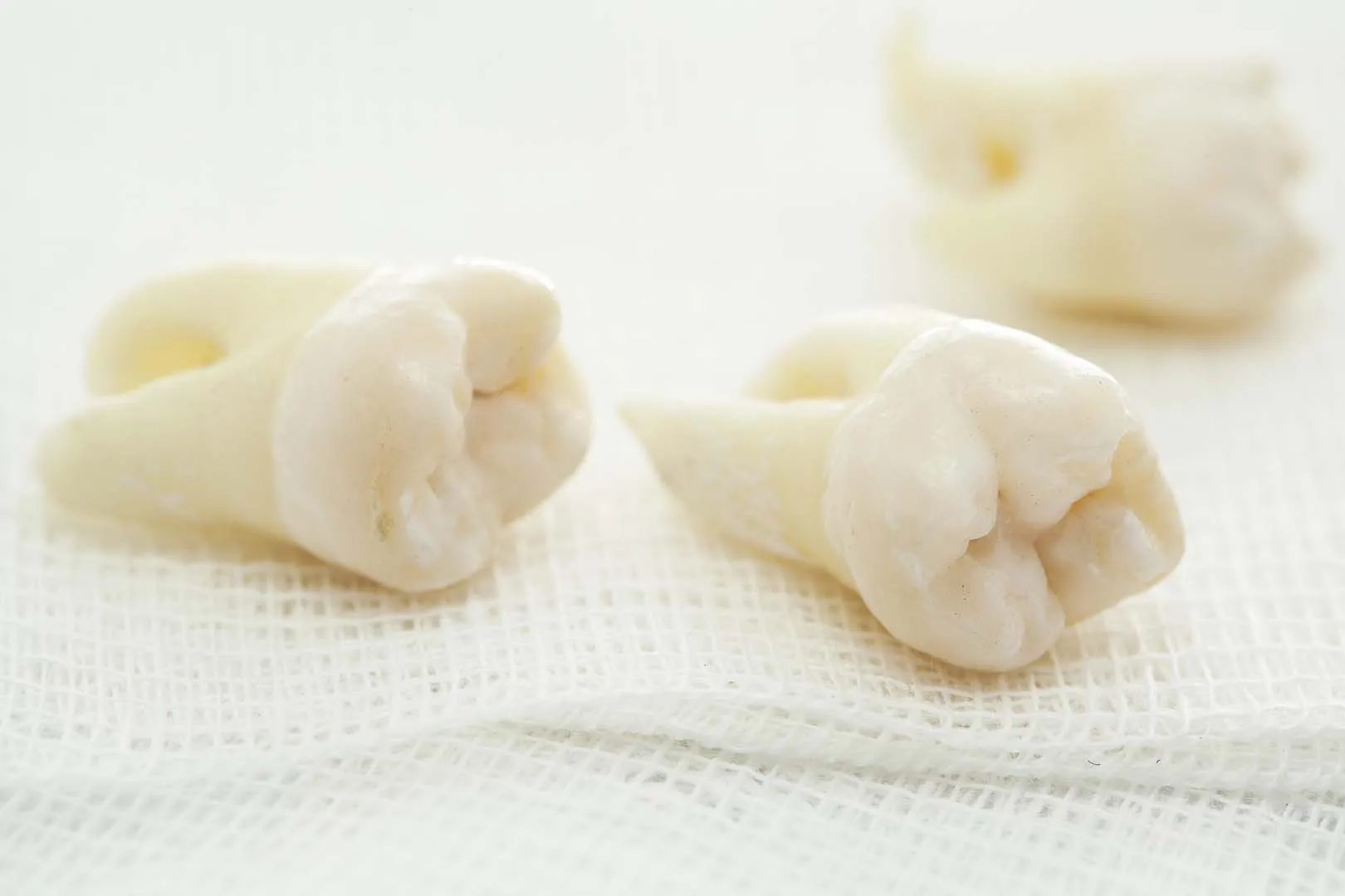 Sedation Options for a Comfortable Experience — Wisdom Teeth Removal in Irvine, CA