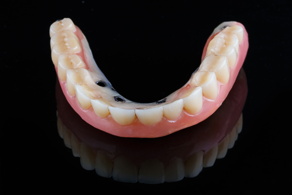 Can Implant Supported Dentures Be Removed?